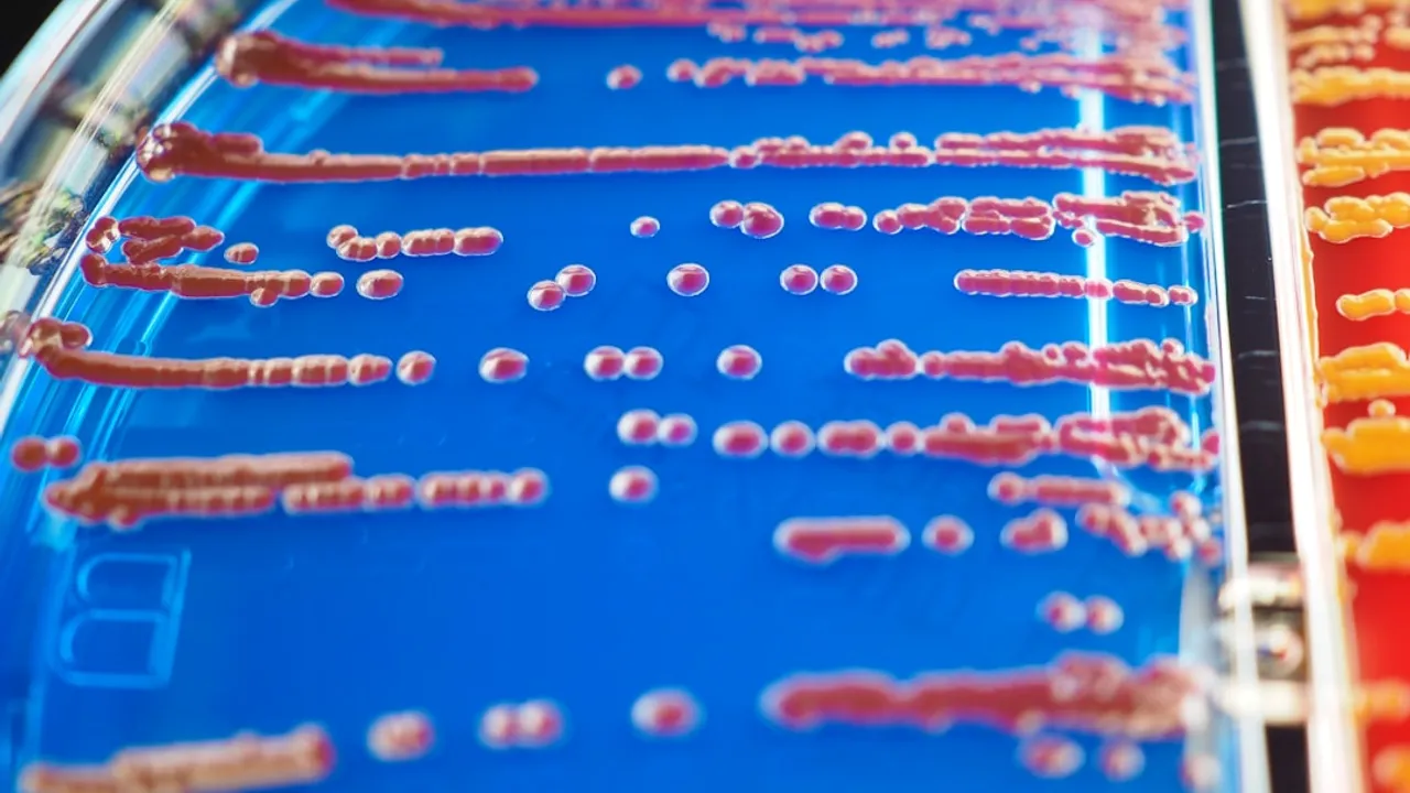 a close up of a tray of food on a table