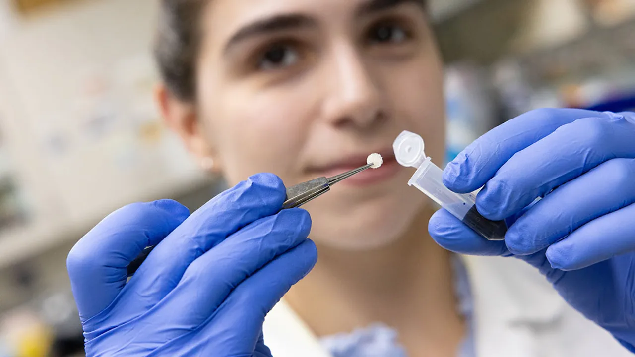 Image from news.med.miami.edu: New Engineering Approaches and Antioxidant Research Open Fresh Doors in Type 1 Diabetes